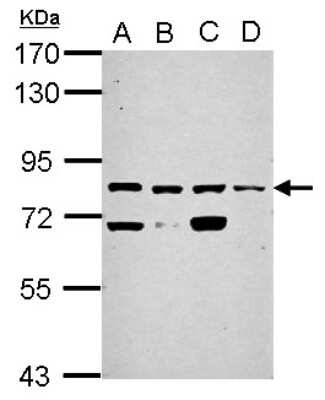 Western Blot: KLHL1 Antibody [NBP2-17076]