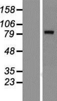 Western Blot: KLHL1 Overexpression Lysate [NBP2-06596]