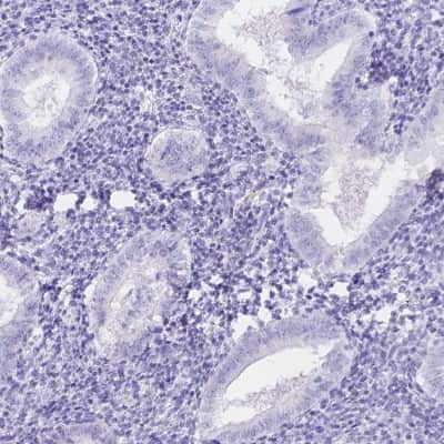 Immunohistochemistry-Paraffin: KLHL10 Antibody [NBP2-49518]