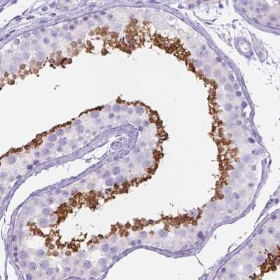 Immunohistochemistry-Paraffin: KLHL10 Antibody [NBP2-49518]