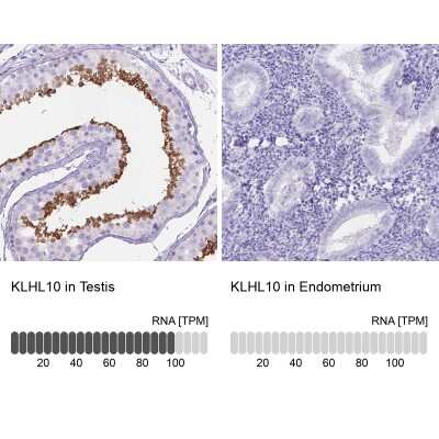 Immunohistochemistry-Paraffin: KLHL10 Antibody [NBP2-49518]