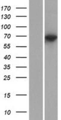 Western Blot: KLHL10 Overexpression Lysate [NBP2-05362]