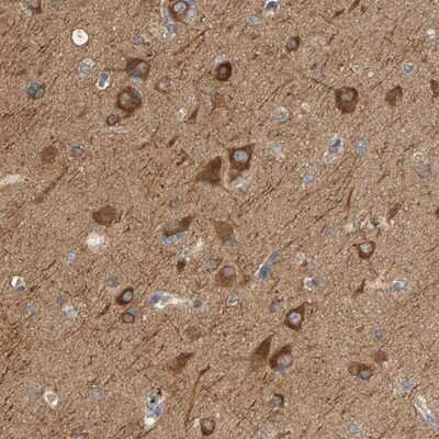 Immunohistochemistry-Paraffin: KLHL11 Antibody [NBP1-83846]