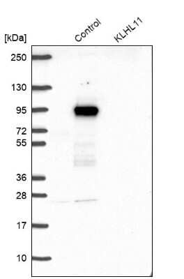 Western Blot: KLHL11 Antibody [NBP1-83846]