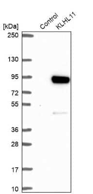 Western Blot: KLHL11 Antibody [NBP2-38721]