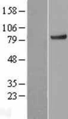 Western Blot: KLHL11 Overexpression Lysate [NBL1-12332]