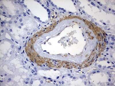 Immunohistochemistry: KLHL12/C3IP1 Antibody (OTI4E1) [NBP2-45512]