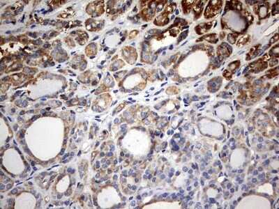 Immunohistochemistry: KLHL12/C3IP1 Antibody (OTI4E1) [NBP2-45512]