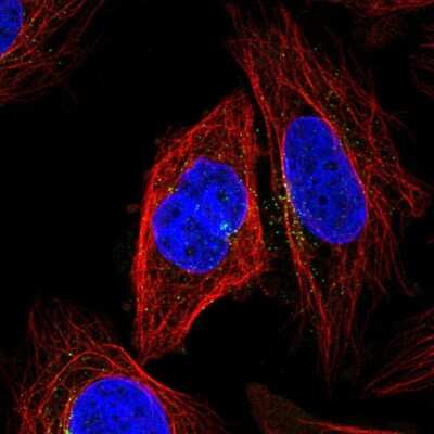Immunocytochemistry/ Immunofluorescence: KLHL12/C3IP1 Antibody [NBP2-56310]