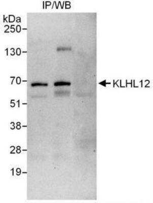 Immunoprecipitation: KLHL12/C3IP1 Antibody [NBP1-49927]