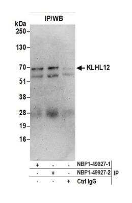 Immunoprecipitation: KLHL12/C3IP1 Antibody [NBP1-49927]