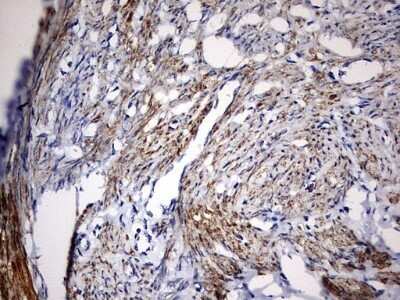 Immunohistochemistry: KLHL12/C3IP1 Antibody (OTI4E1) - Azide and BSA Free [NBP2-72118]