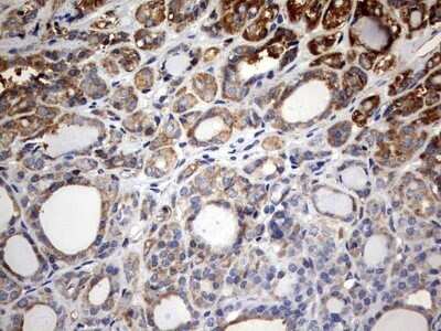 Immunohistochemistry: KLHL12/C3IP1 Antibody (OTI4E1) - Azide and BSA Free [NBP2-72118]