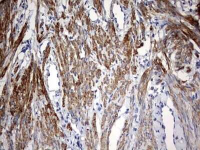 Immunohistochemistry: KLHL12/C3IP1 Antibody (OTI4E1) - Azide and BSA Free [NBP2-72118]