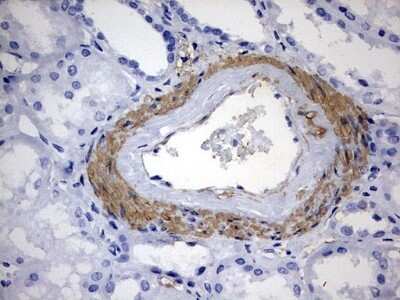 Immunohistochemistry: KLHL12/C3IP1 Antibody (OTI4E1) - Azide and BSA Free [NBP2-72118]
