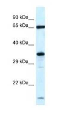 Western Blot: KLHL12/C3IP1 Antibody [NBP1-82404]