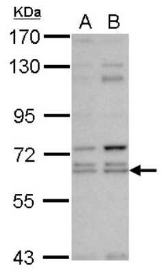 Western Blot: KLHL12/C3IP1 Antibody [NBP2-17077]