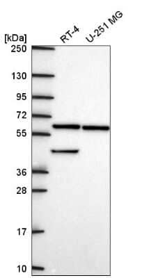 Western Blot: KLHL12/C3IP1 Antibody [NBP2-56310]