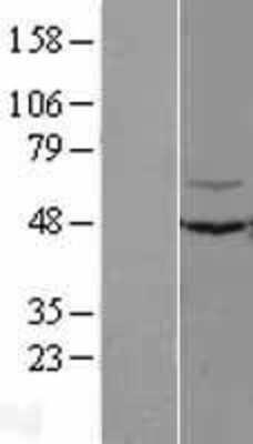 Western Blot: KLHL12/C3IP1 Overexpression Lysate [NBL1-12333]