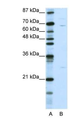 Western Blot: KLHL13 Antibody [NBP1-80047]