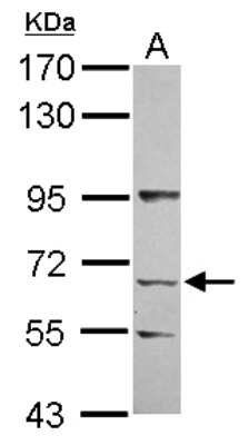 Western Blot: KLHL13 Antibody [NBP2-21610]