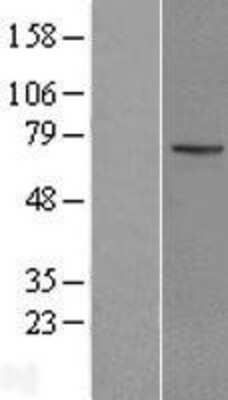 Western Blot: KLHL13 Overexpression Lysate [NBL1-12334]