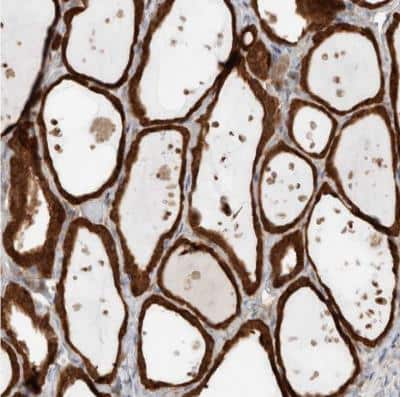 Immunohistochemistry-Paraffin: KLHL14 Antibody [NBP1-81413]