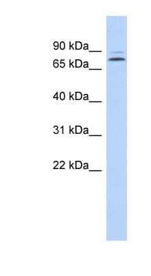 Western Blot: KLHL14 Antibody [NBP1-79457]