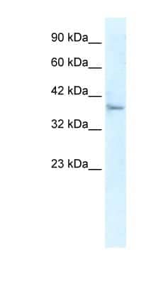 Western Blot: KLHL14 Antibody [NBP1-80048]