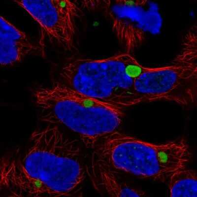 Immunocytochemistry/ Immunofluorescence: KLHL15 Antibody [NBP2-38077]