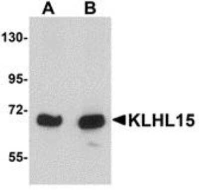 Western Blot: KLHL15 AntibodyBSA Free [NBP1-77359]