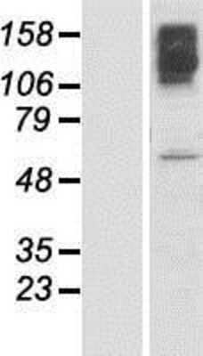 Western Blot: KLHL15 Overexpression Lysate [NBP2-06211]