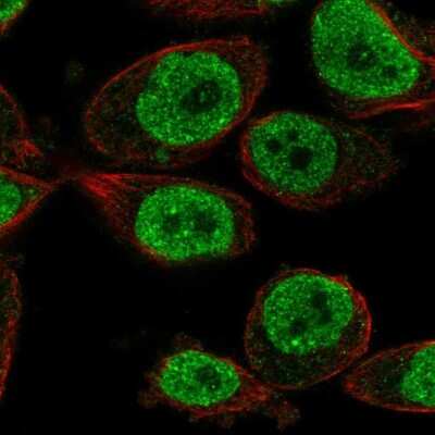 Immunocytochemistry/ Immunofluorescence: KLHL18 Antibody [NBP1-94017]