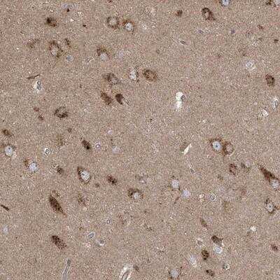 Immunohistochemistry: KLHL18 Antibody [NBP1-94017]
