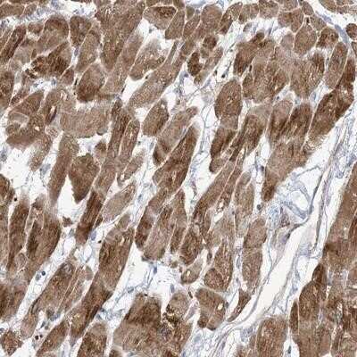 Immunohistochemistry-Paraffin: KLHL18 Antibody [NBP1-94016]