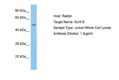 Western Blot: KLHL18 Antibody [NBP2-85160]