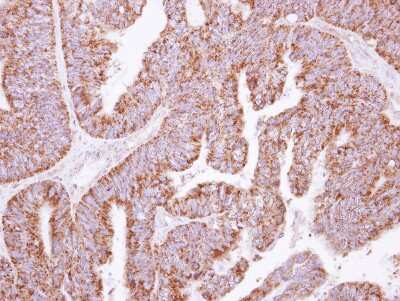 Immunohistochemistry-Paraffin: KLHL2 Antibody [NBP2-17080]