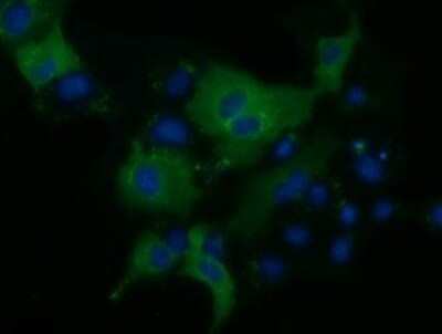 Immunocytochemistry/ Immunofluorescence: KLHL2 Antibody (OTI1G7) - Azide and BSA Free [NBP2-71695]