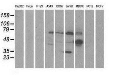 Western Blot: KLHL2 Antibody (OTI1G7)Azide and BSA Free [NBP2-71695]