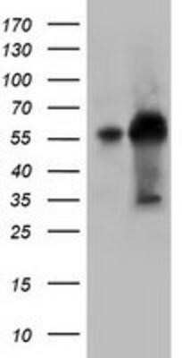 Western Blot: KLHL2 Antibody (OTI1G7)Azide and BSA Free [NBP2-71695]