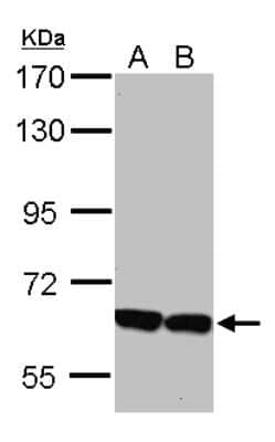 Western Blot: KLHL2 Antibody [NBP2-17080]