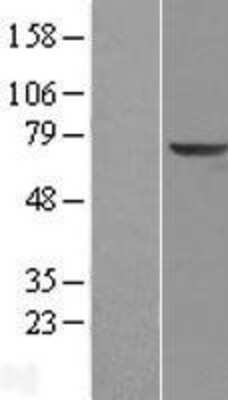 Western Blot: KLHL2 Overexpression Lysate [NBL1-12335]