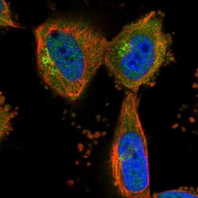 Immunocytochemistry/ Immunofluorescence: KLHL20 Antibody [NBP1-81559]