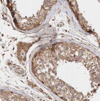 Immunohistochemistry-Paraffin: KLHL20 Antibody [NBP1-81559]