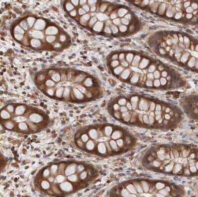 Immunohistochemistry-Paraffin: KLHL20 Antibody [NBP1-81559]