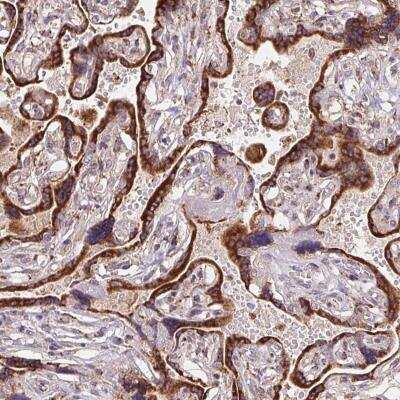 Immunohistochemistry-Paraffin: KLHL20 Antibody [NBP2-38708]