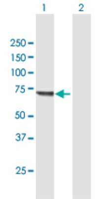 Western Blot: KLHL20 Antibody [H00027252-B01P]