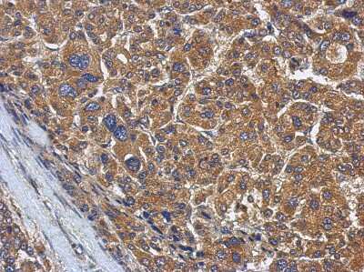 Immunohistochemistry-Paraffin: KLHL22 Antibody [NBP2-17081]