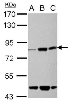 Western Blot: KLHL22 Antibody [NBP2-17081]