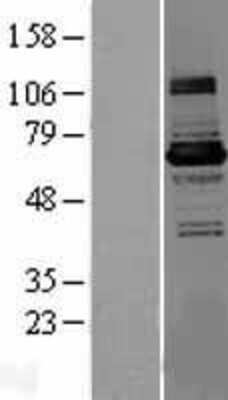 Western Blot: KLHL22 Overexpression Lysate [NBL1-12336]